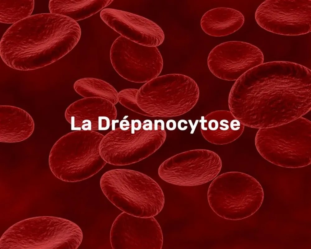 Drépanocytose au Bénin : « Une urgence de santé publique encore sous-estimée », alerte le Dr Gnanvi Ayodélé Douceline
